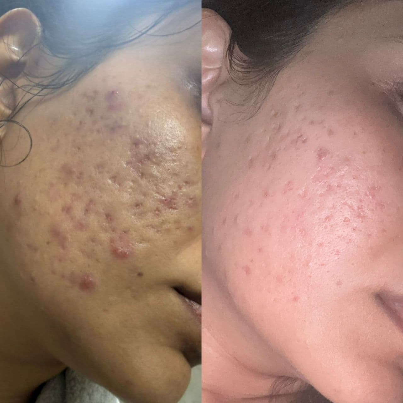 Before and After result 0