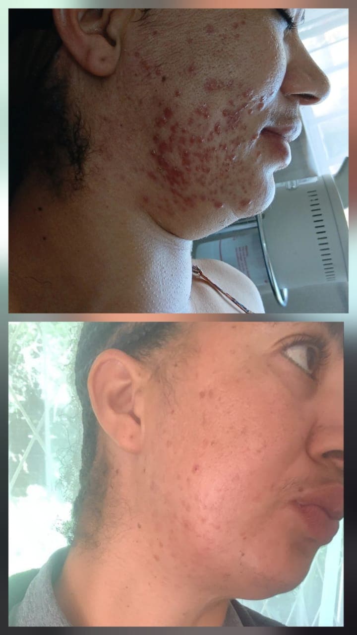 Before and After result 2