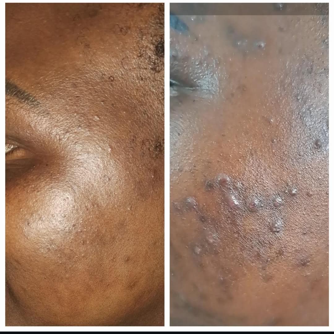 Before and After result 6