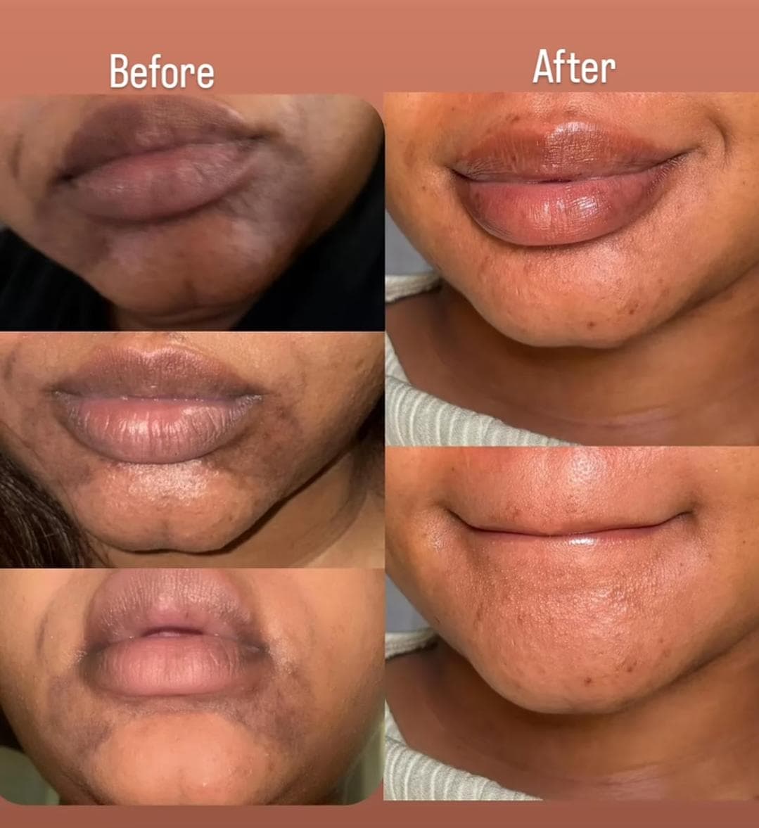 Before and After Results